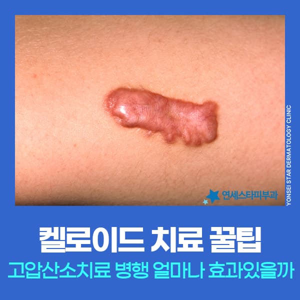 blog-224418897747