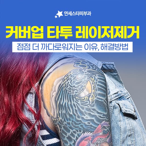 커버업타투제거가 어려운 이유, R0 테크닉 문신제거 계획