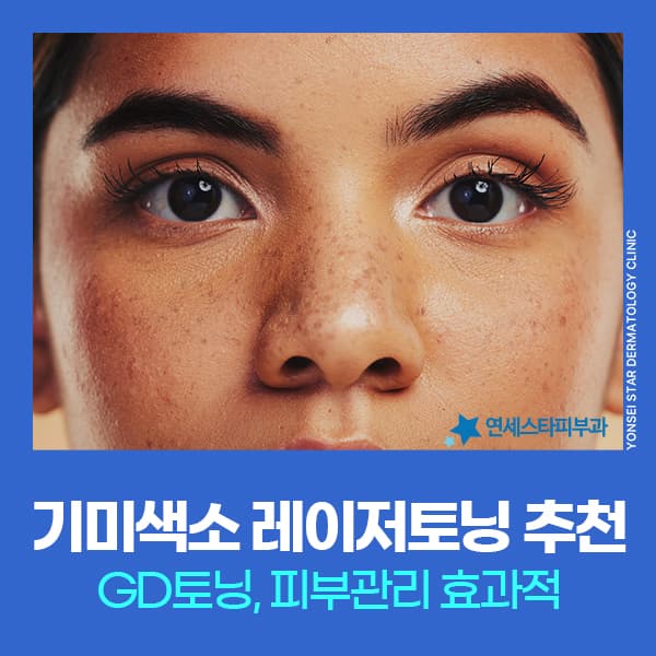 레이저토닝 추천 고민, GD토닝 색소 피부관리 원리