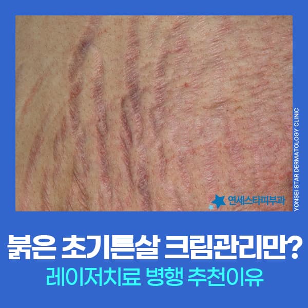 blog-224426121669