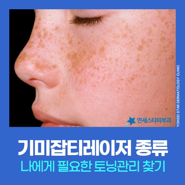 신촌 기미잡티레이저 종류별 특징과 기미제거레이저 관리