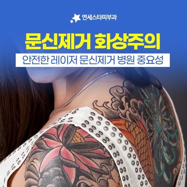 신촌 셀프문신제거와 문신제거화상, 문신제거병원 선택 기준