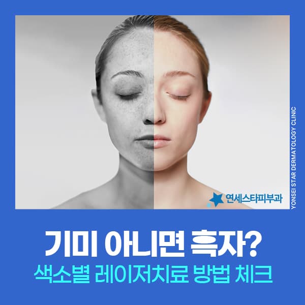 신촌 기미·흑자 차이와 색소레이저 선택