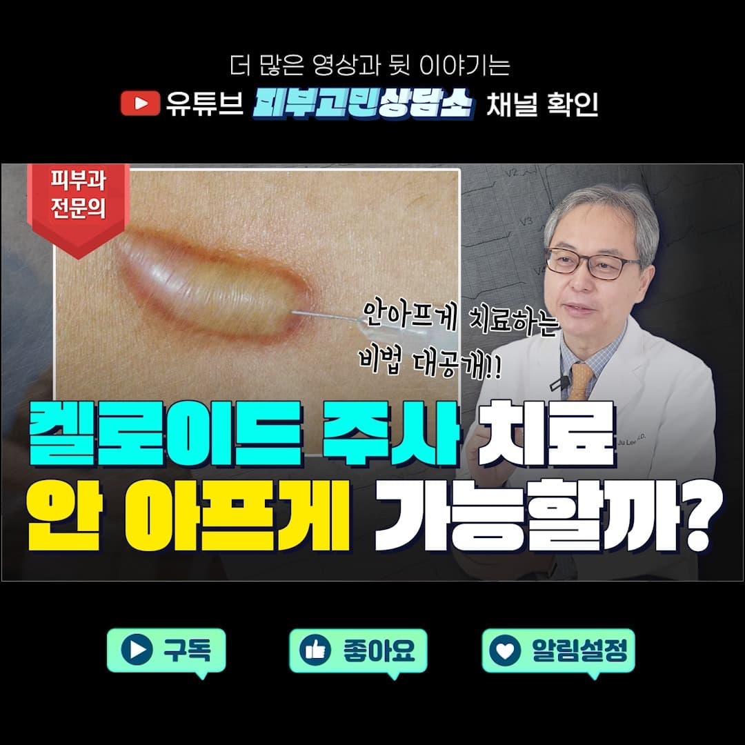 Secret to drastically ↘️ reducing keloid injection pain revealed