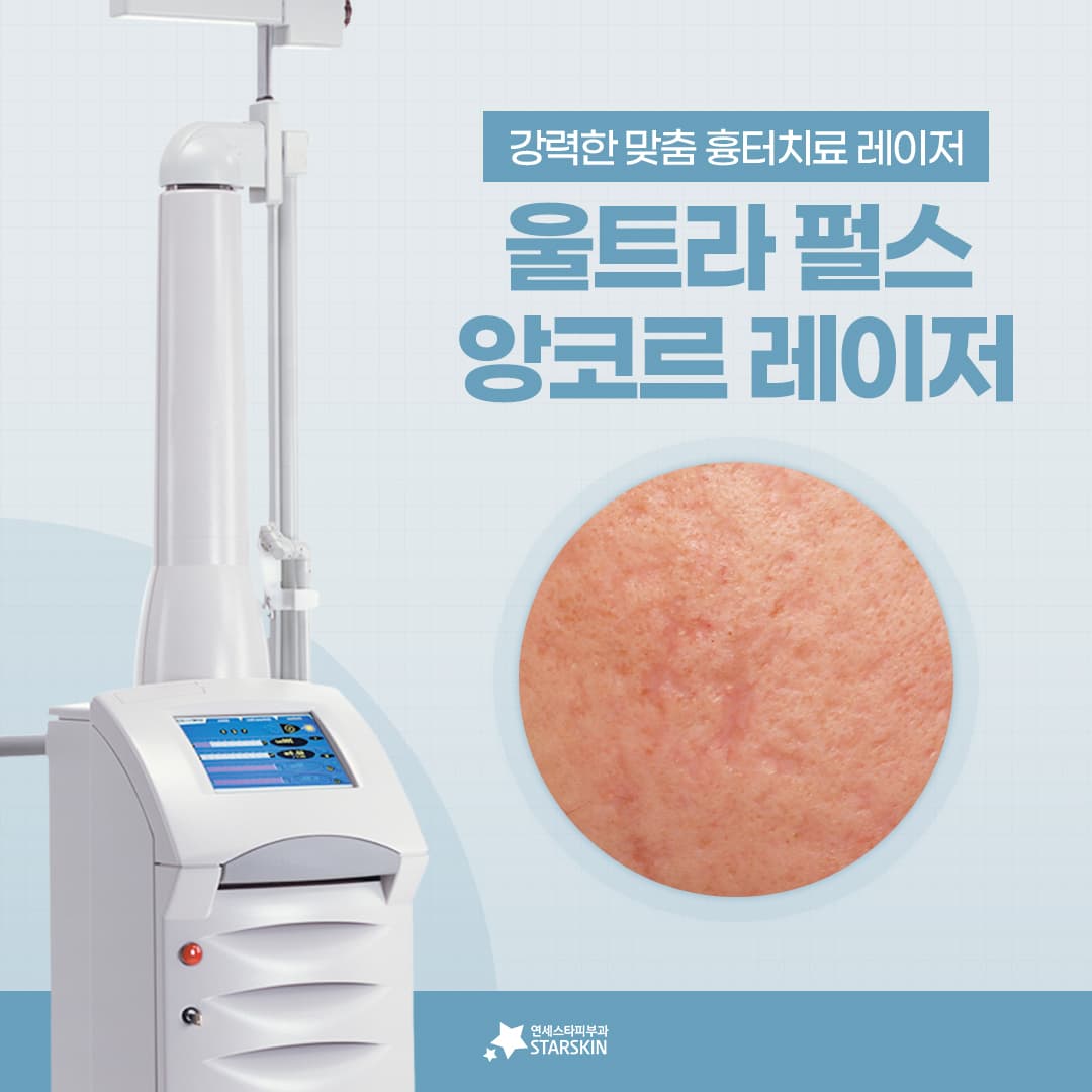 ➡️울트라펄스앙코르레이저란?