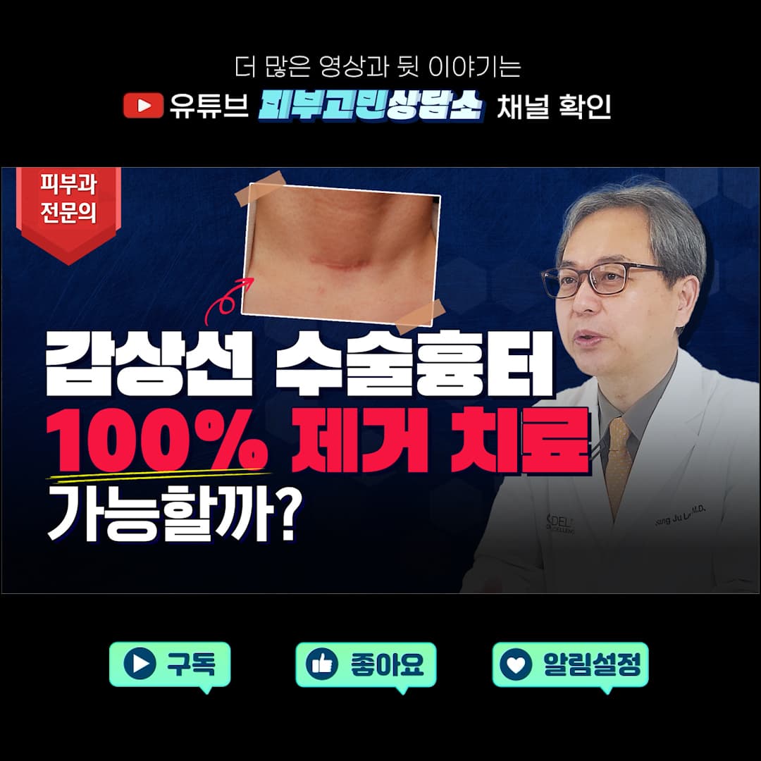 갑상선 수술 흉터 100% 제거 치료 가능할까? 🧏🏻♂️