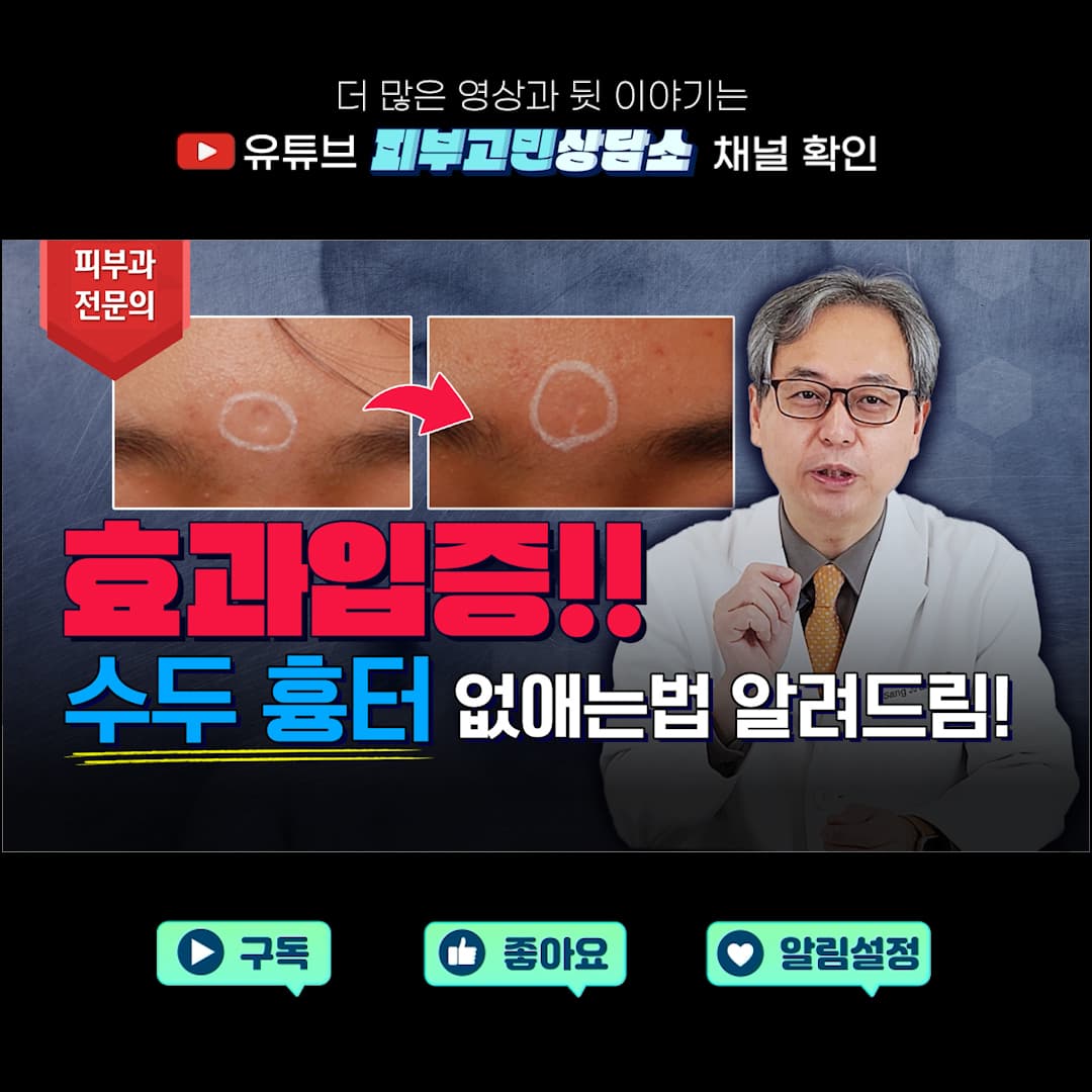 古い水痘跡の除去❌可能?