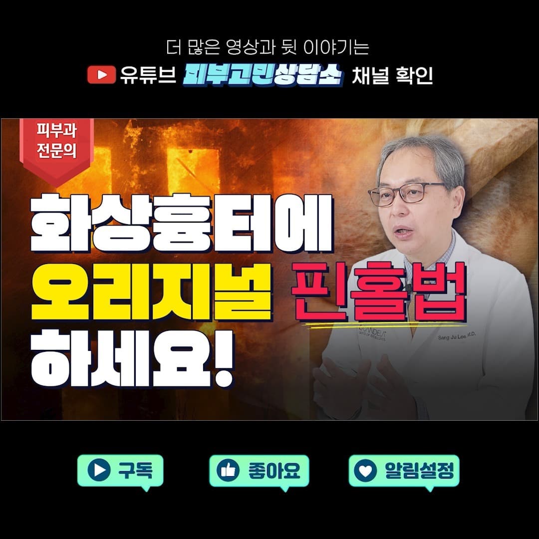 화상흉터에 효과적인 오리지널 핀홀법 🙋♂️여기입니다