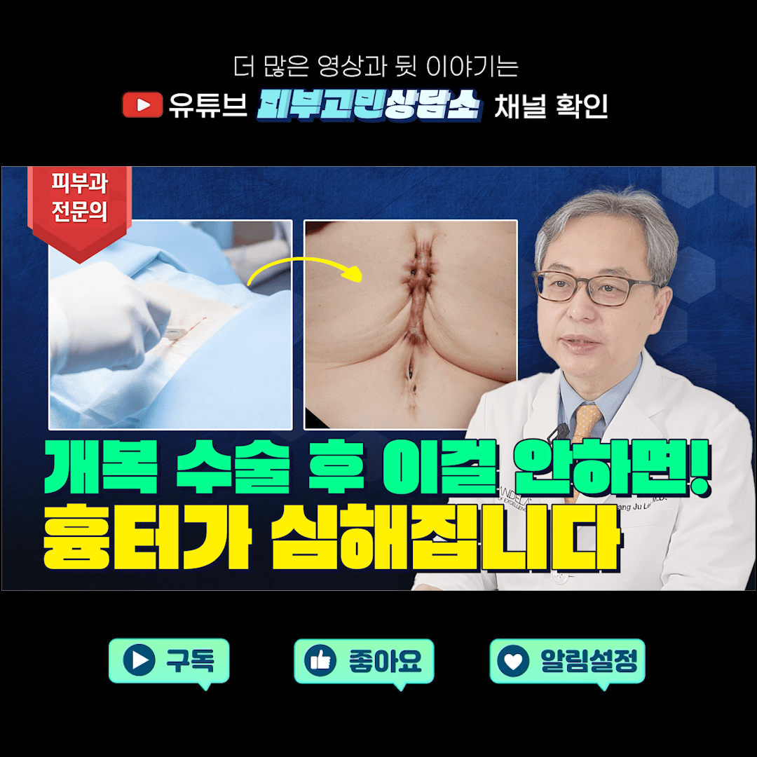개복 수술 후 흉터 만들고 싶지 않다면 ※ 필수시청 ※ | 암 수술 후 관리 (Feat. 수술흉터 없애는법)