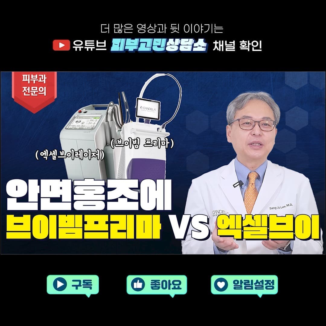 안면홍조에 브이빔프리마 할까? 엑셀브이 할까? 🤔