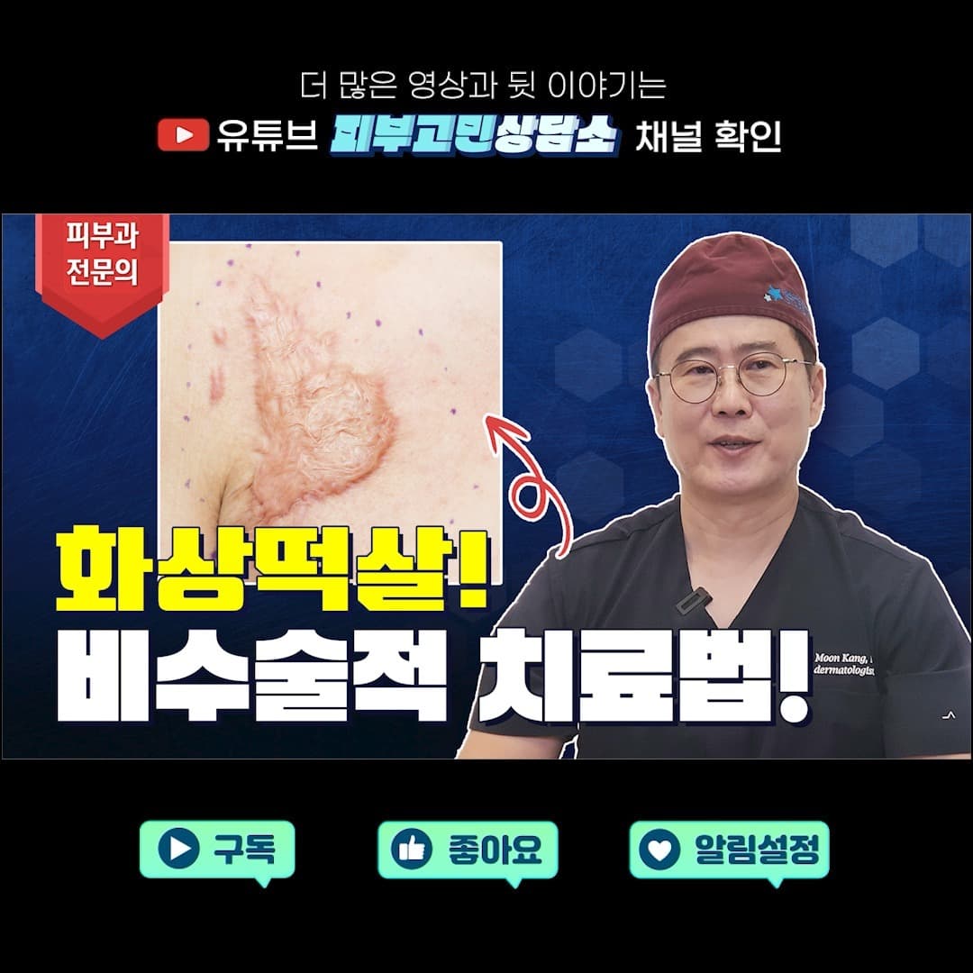 NO Surgery🙅🏻♂️ How to Effectively Treat Burn Hypertrophic Scars