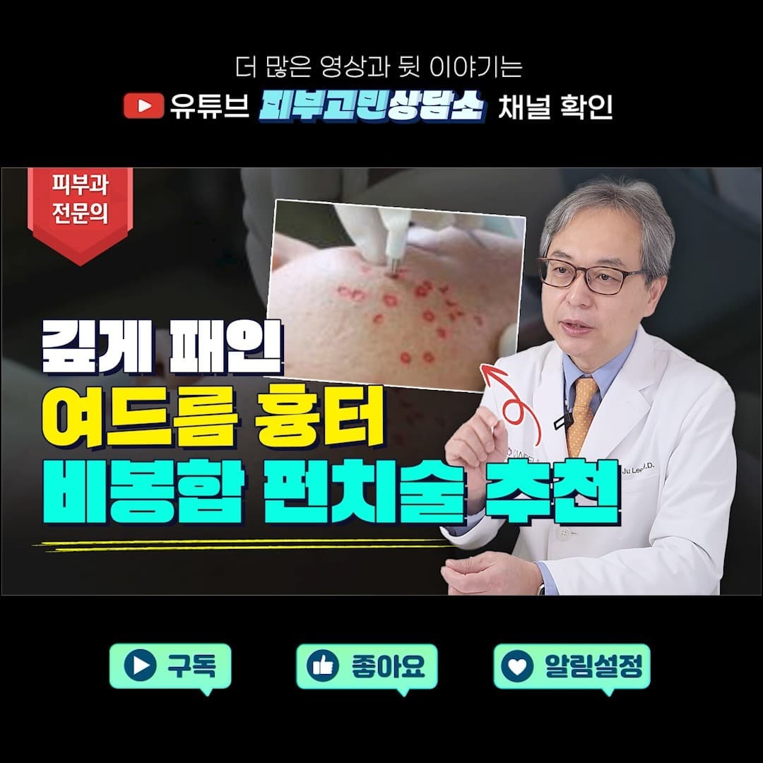 깊게 패인 여드름 흉터 치료는 정말 쉽지 않습니다😭😭
