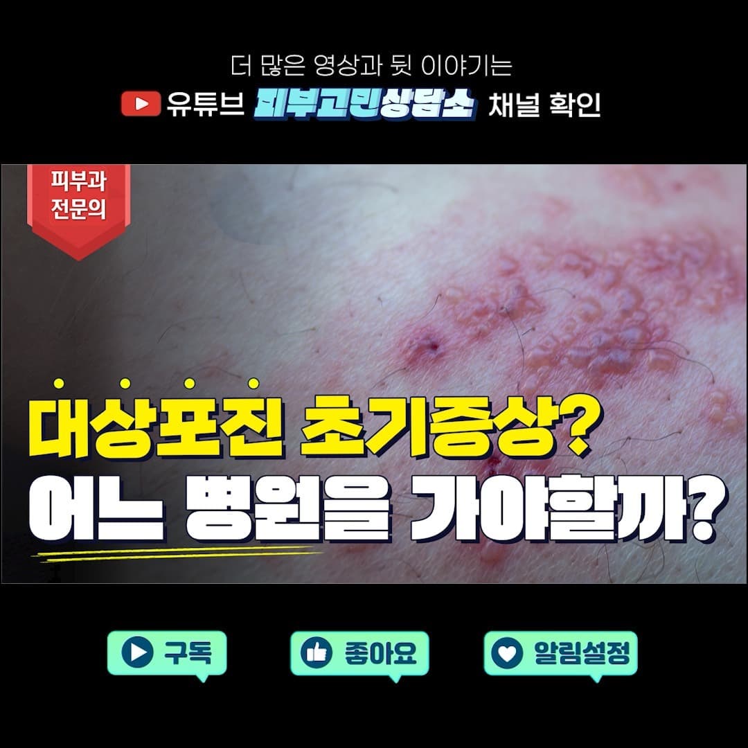 극심한 통증과 수포로 고생하는 대상포진 ☝🏻
