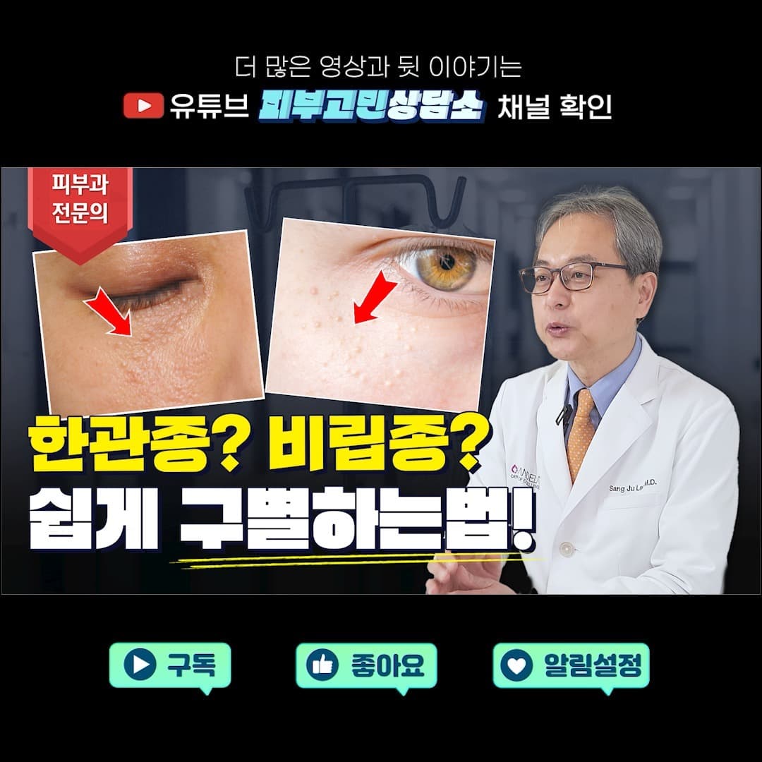 이마나 뺨, 눈 주변 등에 좁쌀 모양으로 오돌토돌하게 올라오는 보기싫은😱 한관종