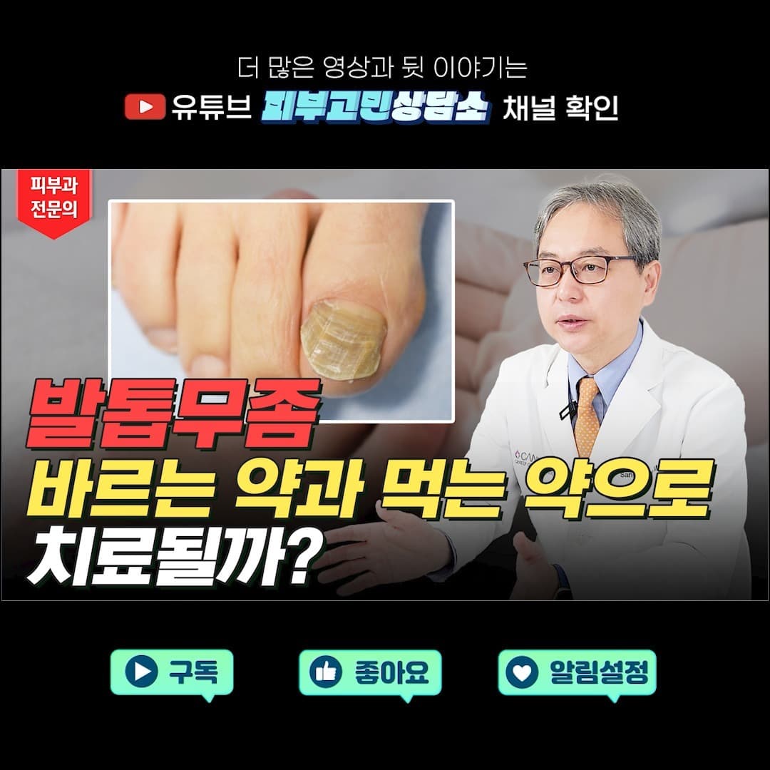 Do you want to get rid of toenail fungus with oral or topical medication? 🙋🏻♀️🙋🏻♂️