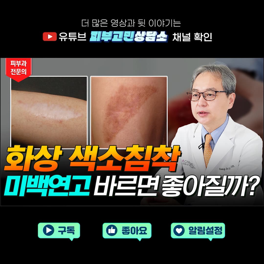 고데기 화상, 난방기구 등에 의한 저온화상, 일광화상 등
