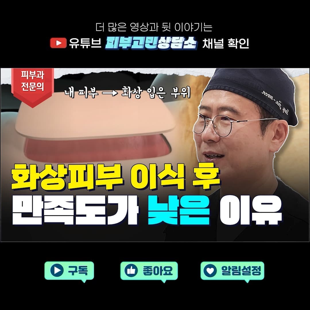 화상 후 피부이식수술을 하게 되면
