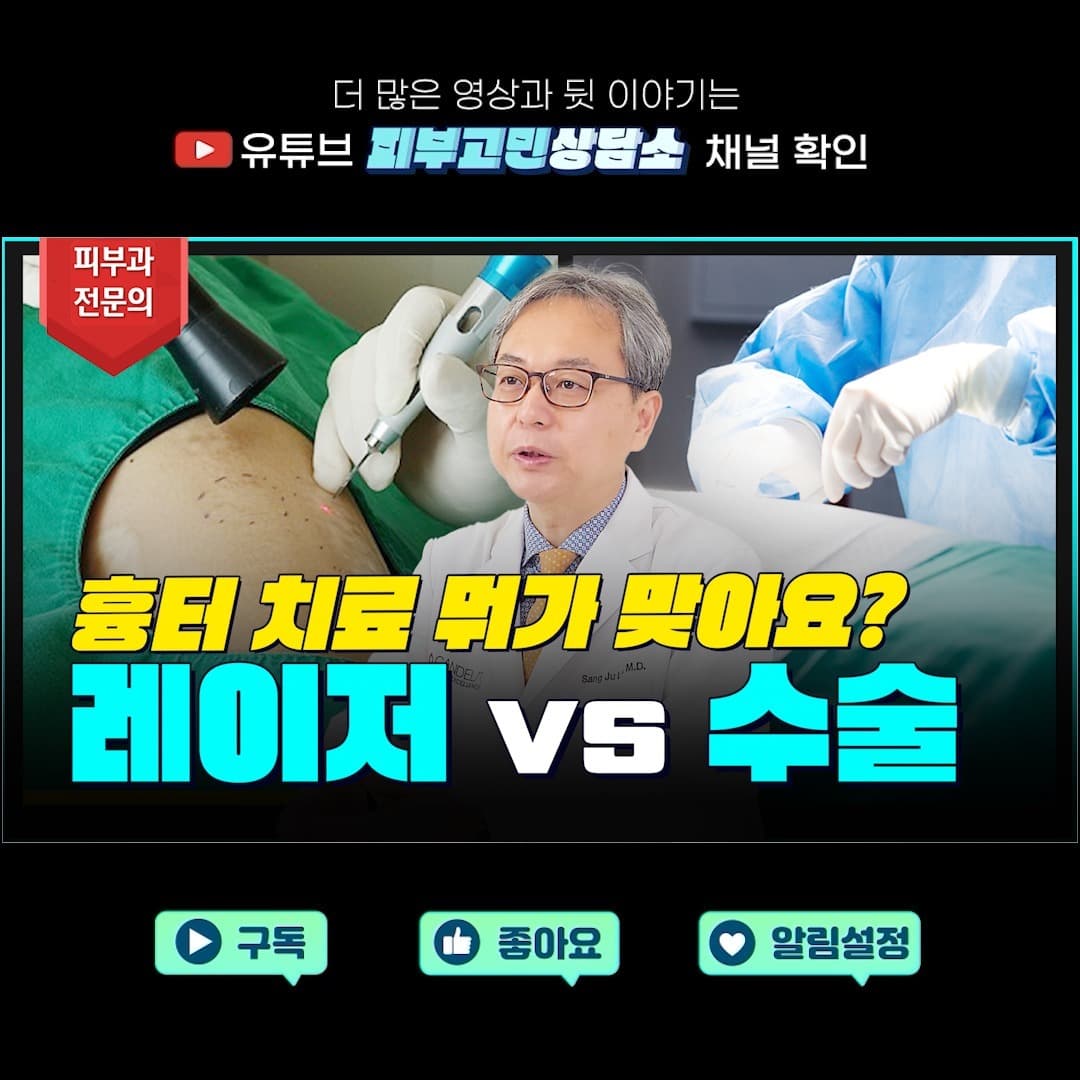 흉터를 치료하고 싶은데 레이저로 할지 수술로 할지