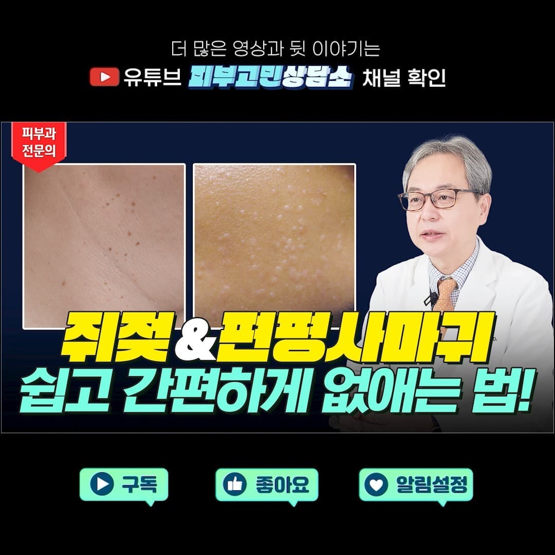 피부 위에 오돌토돌 올라오는 쥐젖과 편평사마귀😭