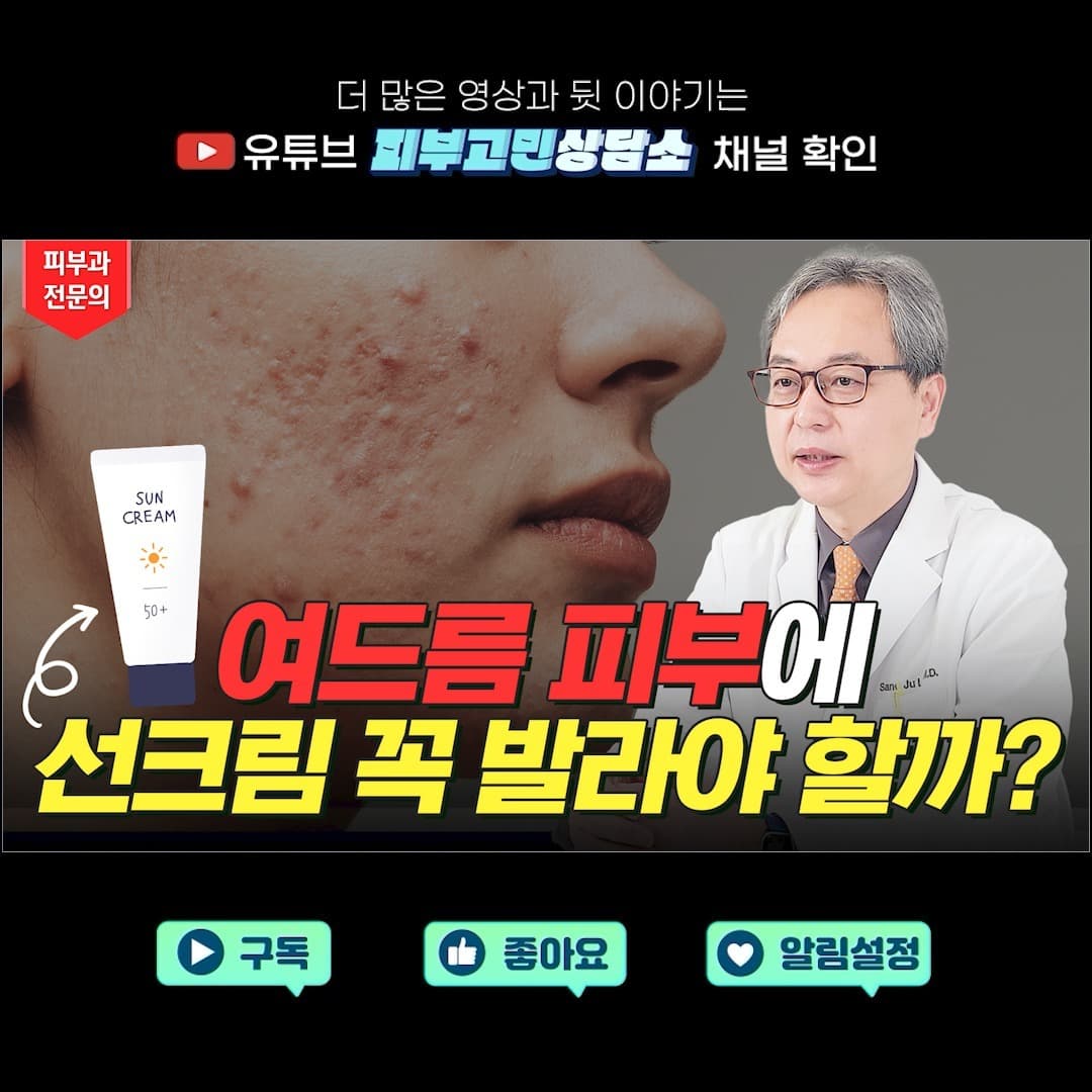 When acne patients approach summer