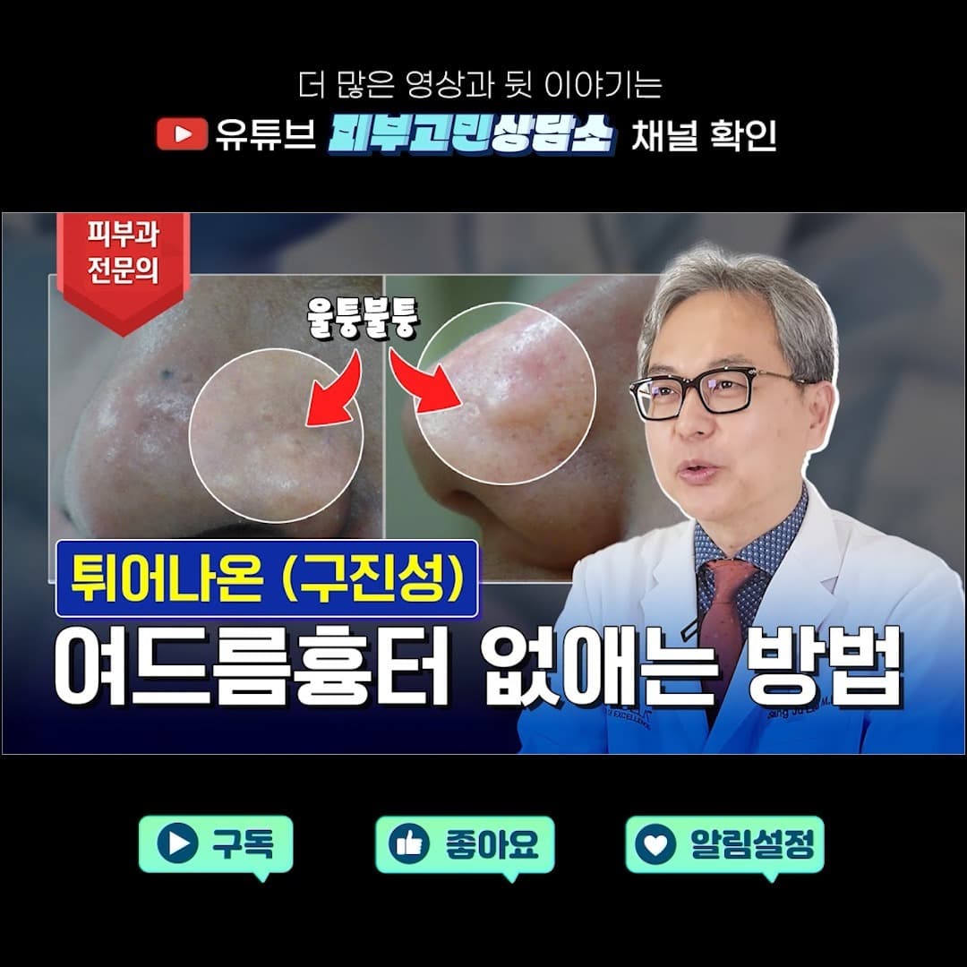 코와 턱 부위에 울퉁불퉁 튀어나온