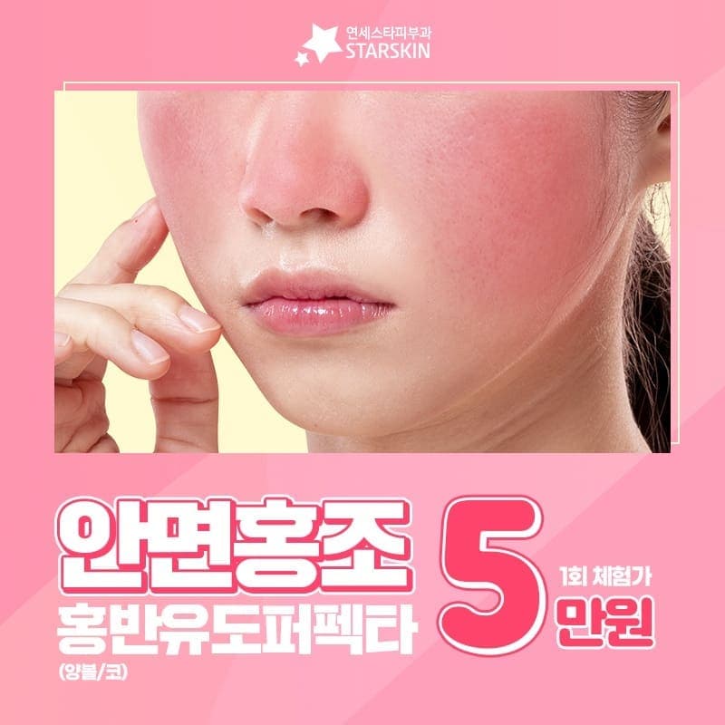 안면홍조 홍반유도퍼펙타