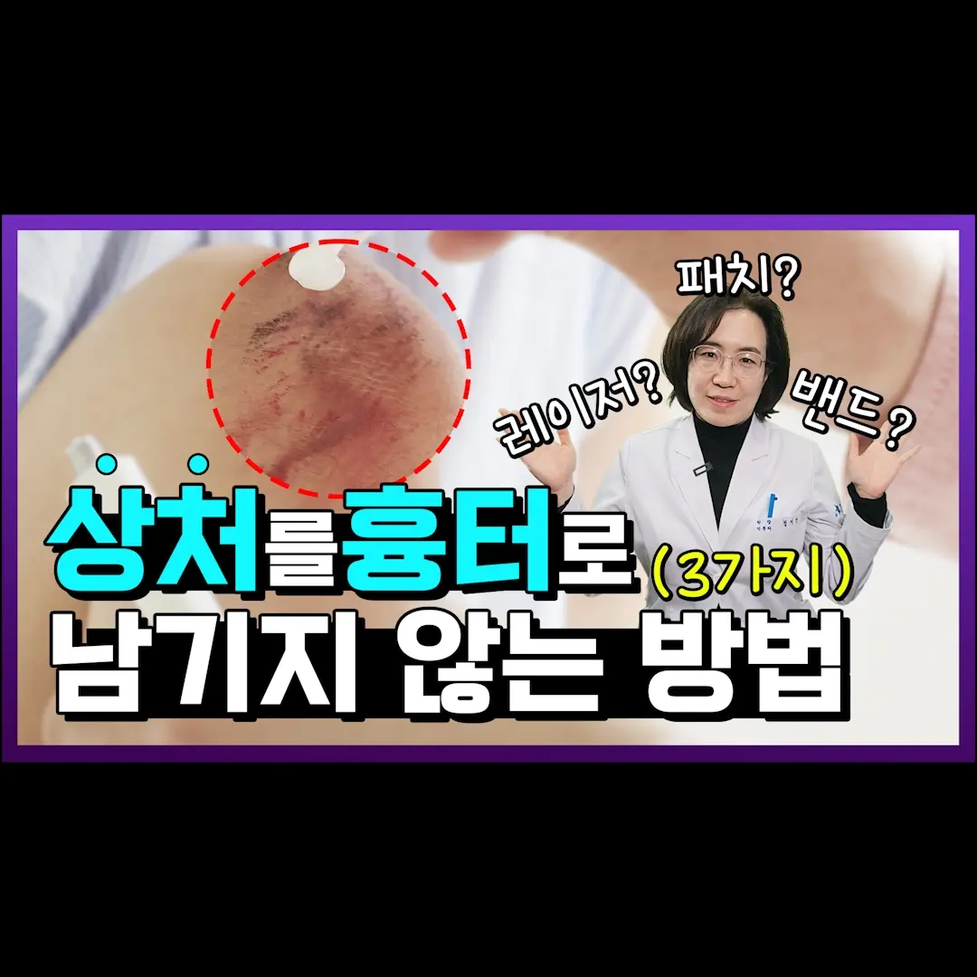Mostly when a small wound occurs