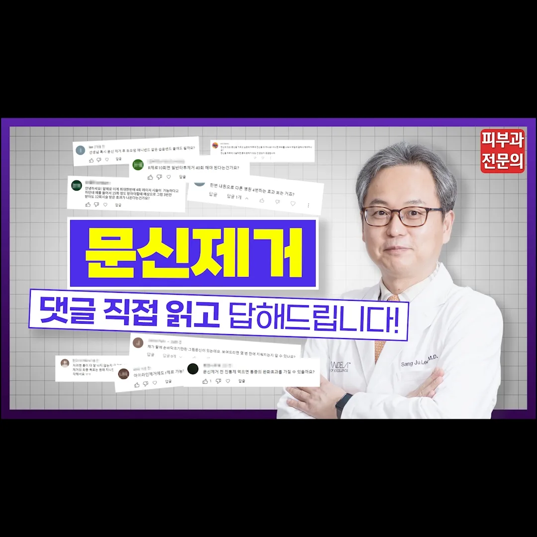 문신제거 원리, 횟수, R제로, 통증, 흉터 등