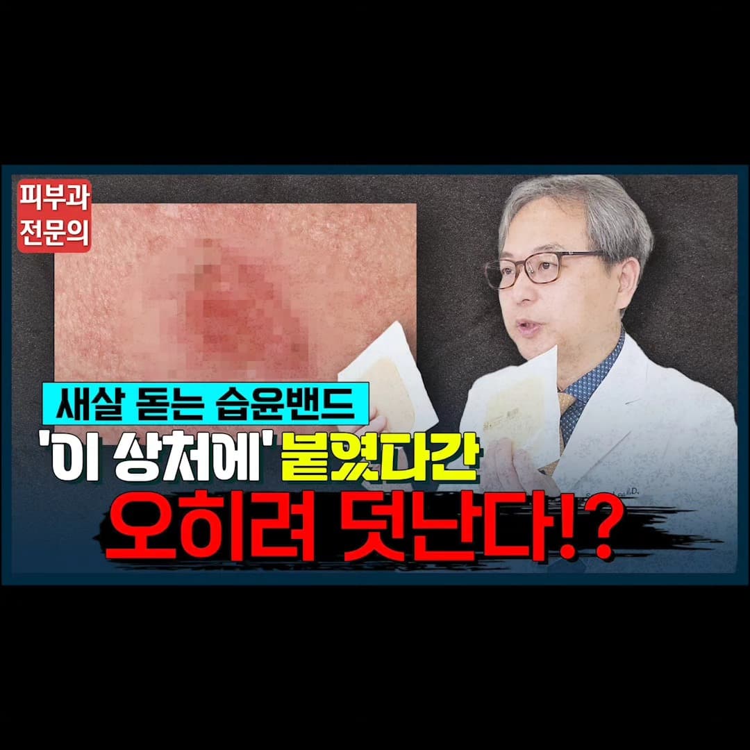 Do you use hydrocolloid bandages 🩹🩹 to prevent scars when you get a wound?