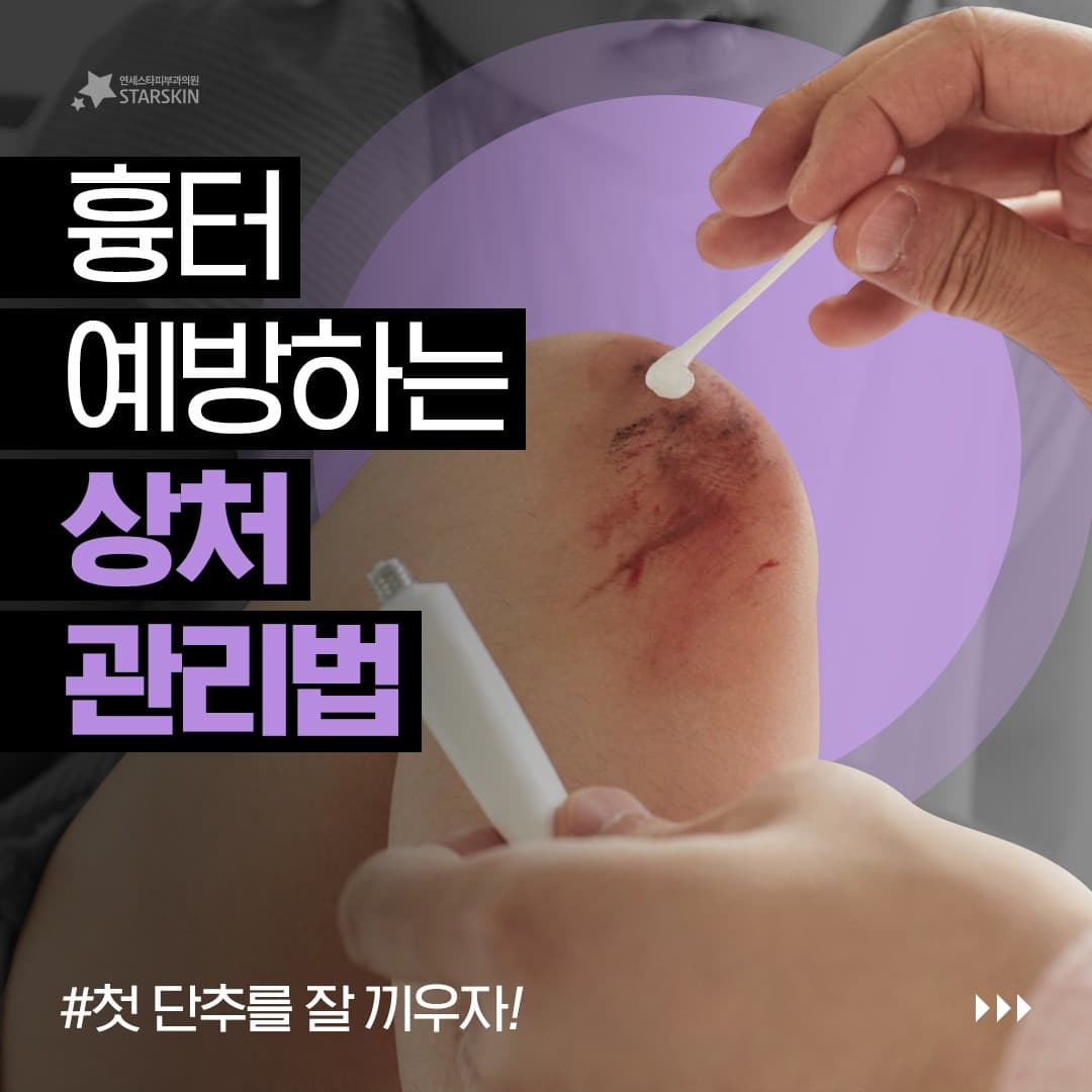 🩹傷跡を予防する傷の手入れ法