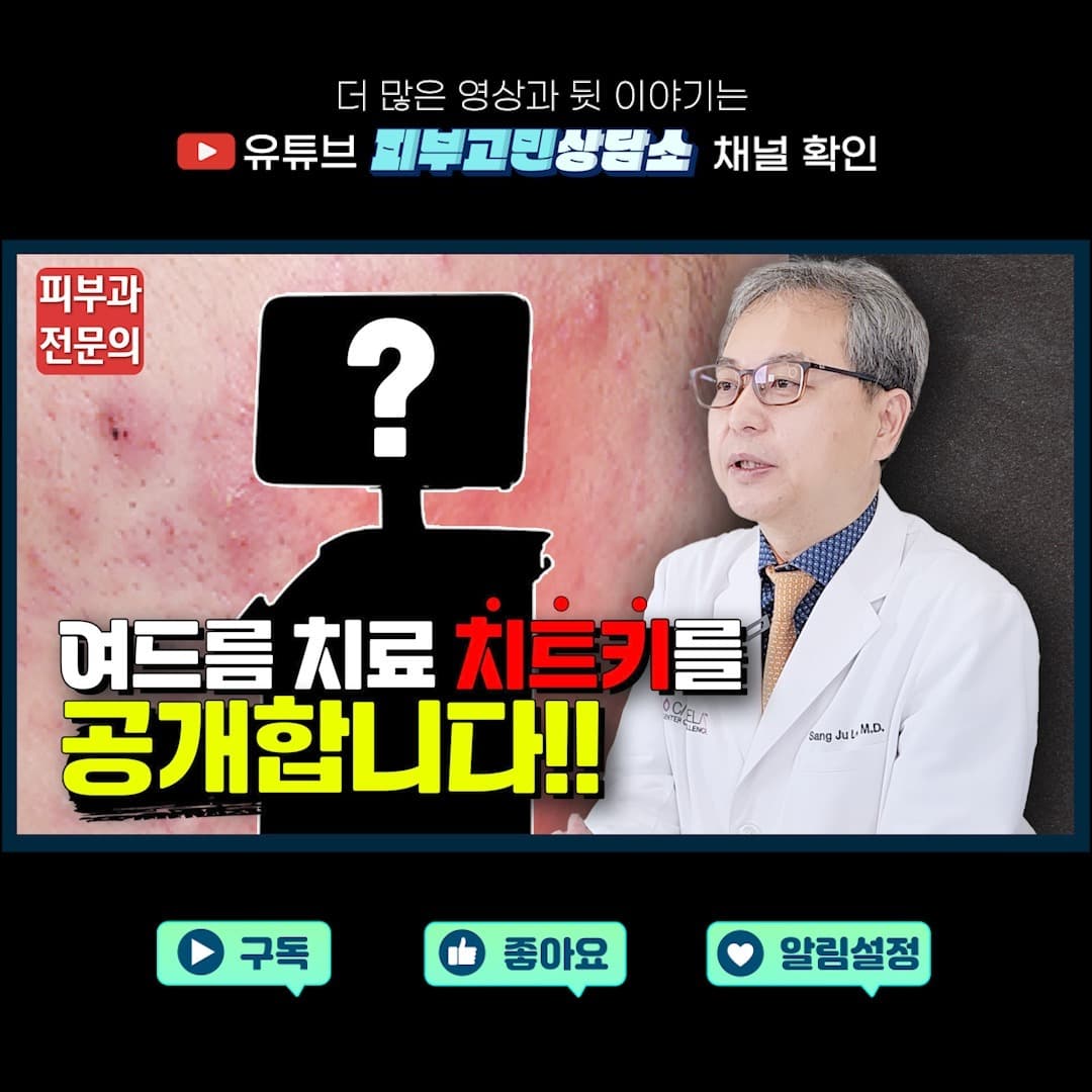여드름 치료 효과 높여주는 방법 🔥시술공개🔥