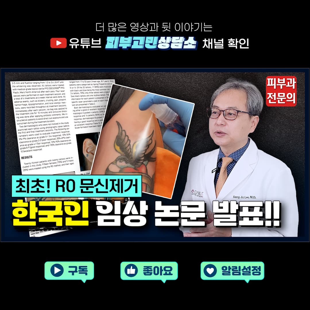 スピーディーなタトゥー除去「R0テクニック」韓国人臨床結果を初公開