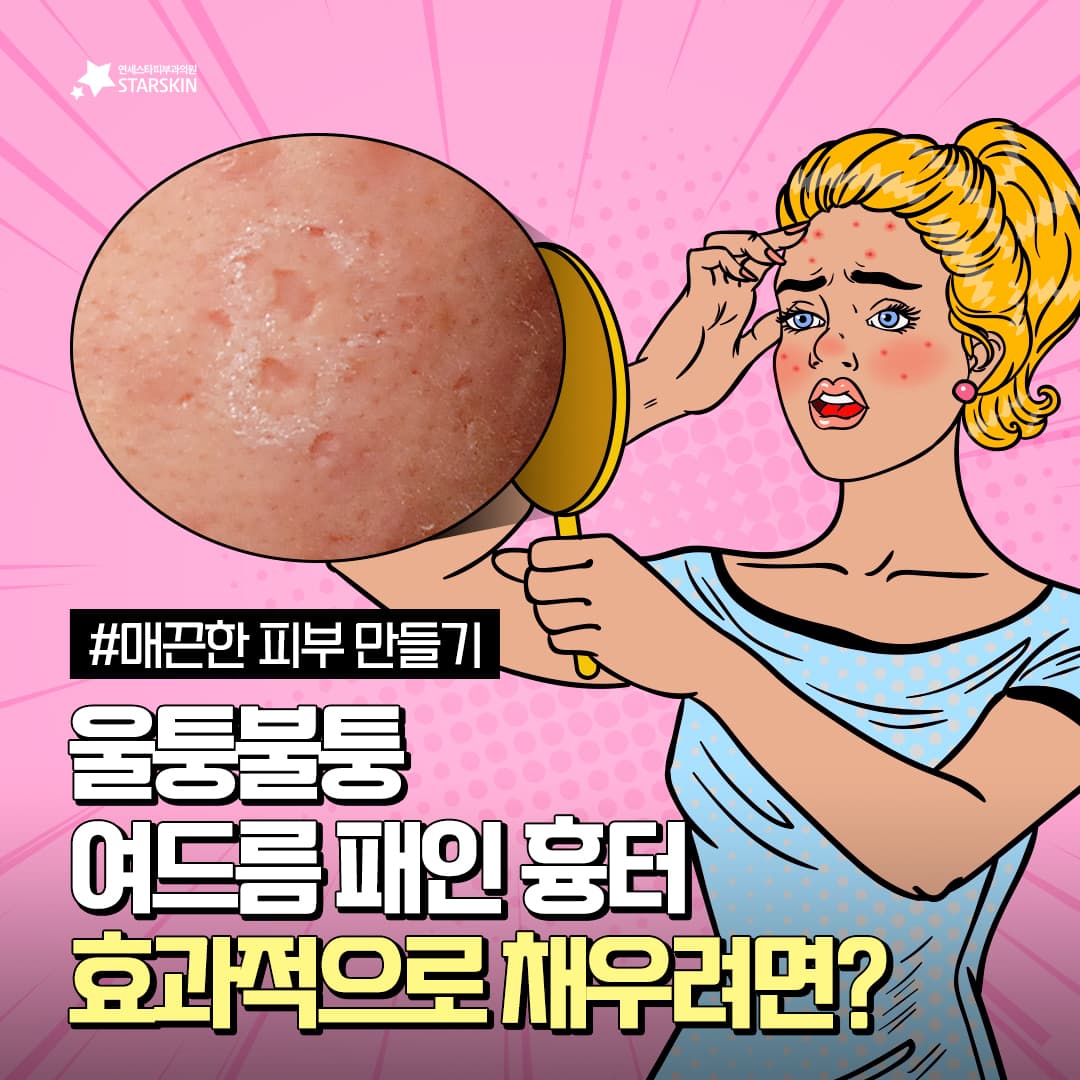 울퉁불퉁 패인 흉터 채우는 방법