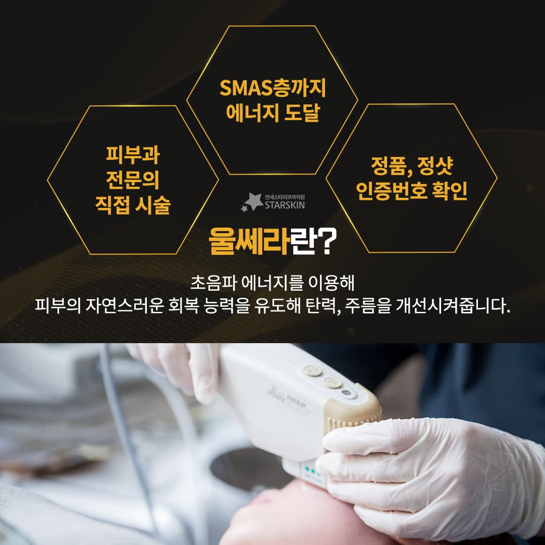 프리미엄 리프팅 시술 울쎄라 ⭐ (2023.11.07)
