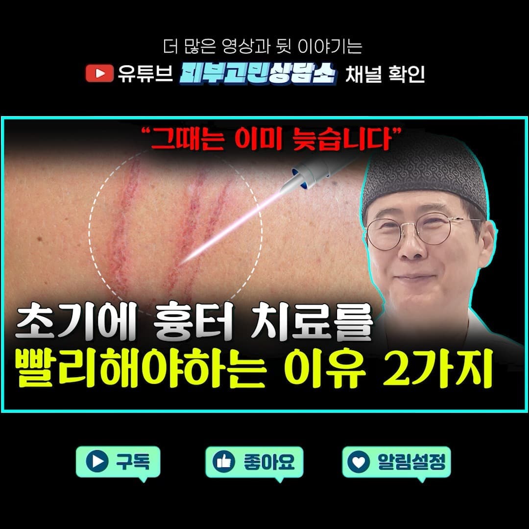 초기 흉터 치료는 흉터가 더 깊어지거나 넓어지는 것을 방지하고, 피부 회복을 촉진하여 흉터의 모양과 크기를 최소화하는 데 중요합니다.