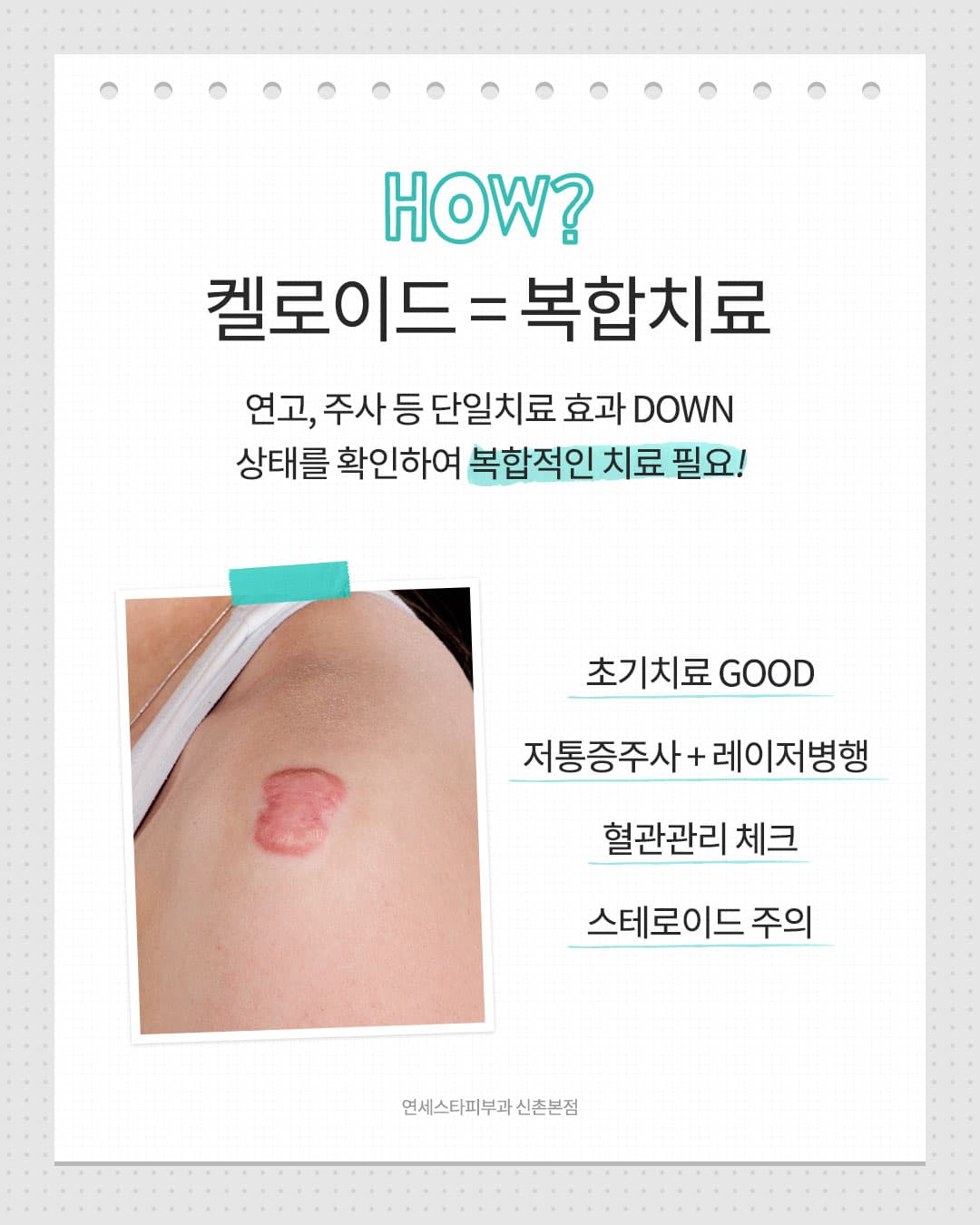 Keloids that keep swelling up