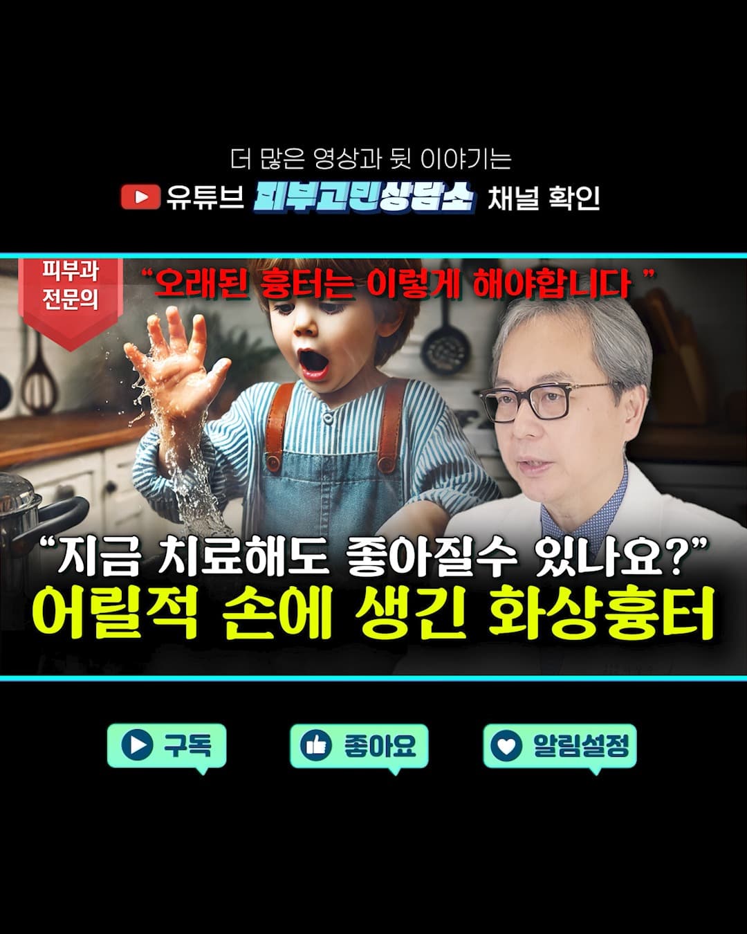 어릴 적 사고로 화상을 입고난 후