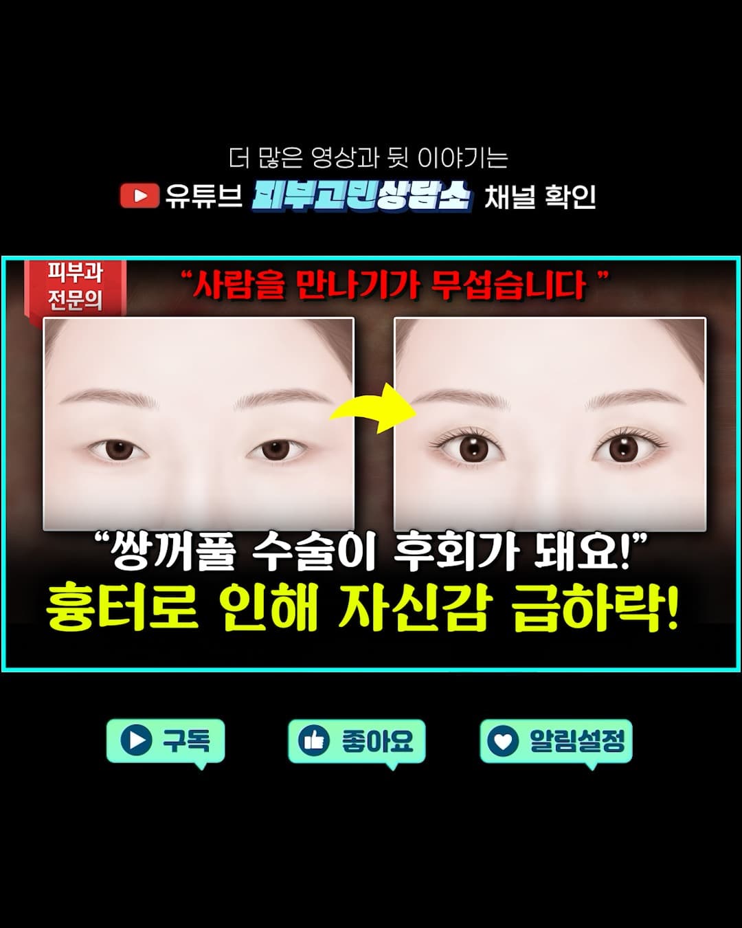 쌍꺼풀 수술 후에 흉터가 남아서 후회하고 계신가요? 😢