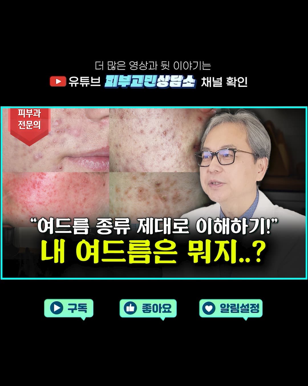 여드름 때문에 고민이신가요? 🤔
