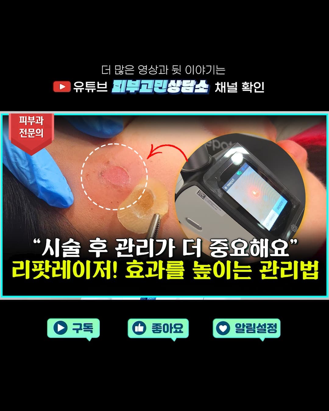 시술만으로 피부가 완벽해질 수 있을까요?