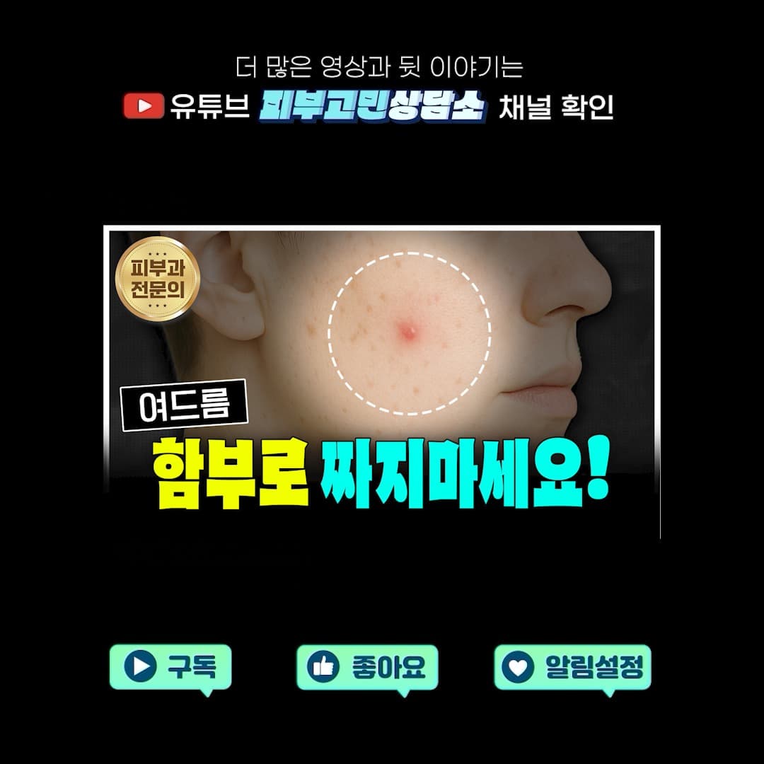 Watching a lot of acne popping videos lately?