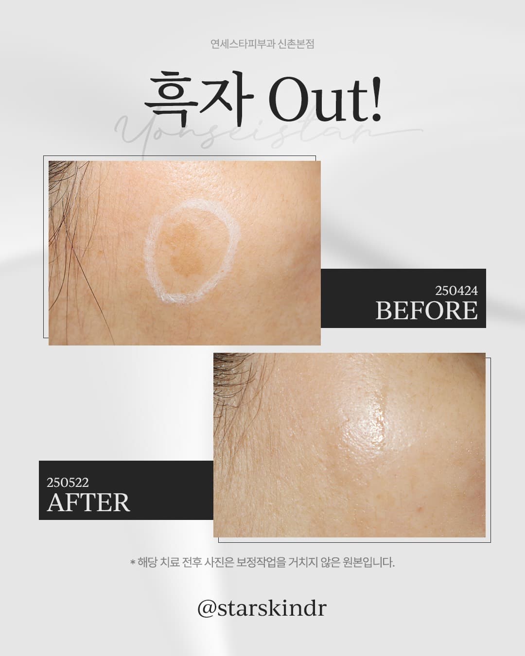 흑자, 한두 번이면 끝!