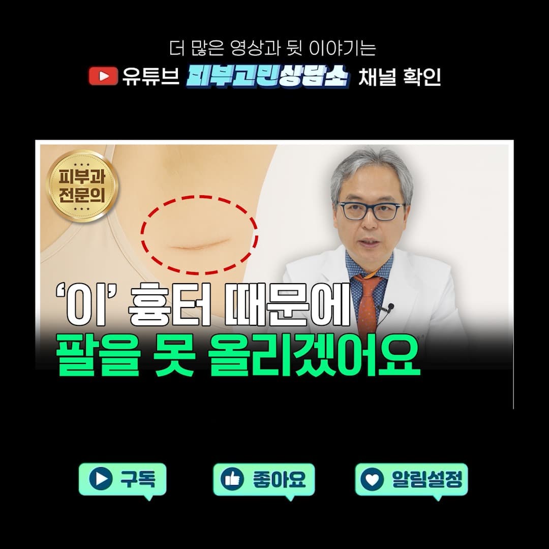 겨드랑이 절개 후 흉터가 남으면, 단순히 보기 싫은 걸 넘어서