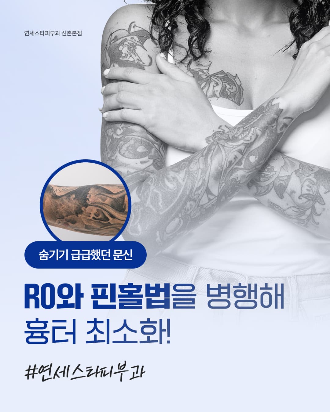 숨기기 바빴던 문신,