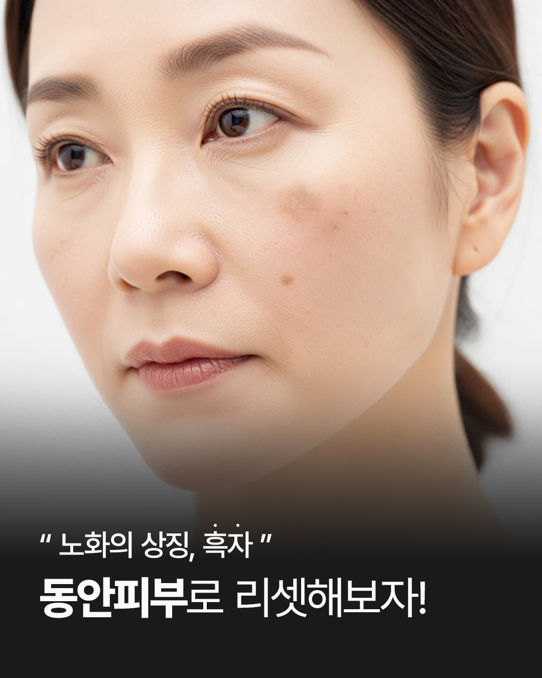 흑자, 몇 번만에 없앨 수 있을까요?