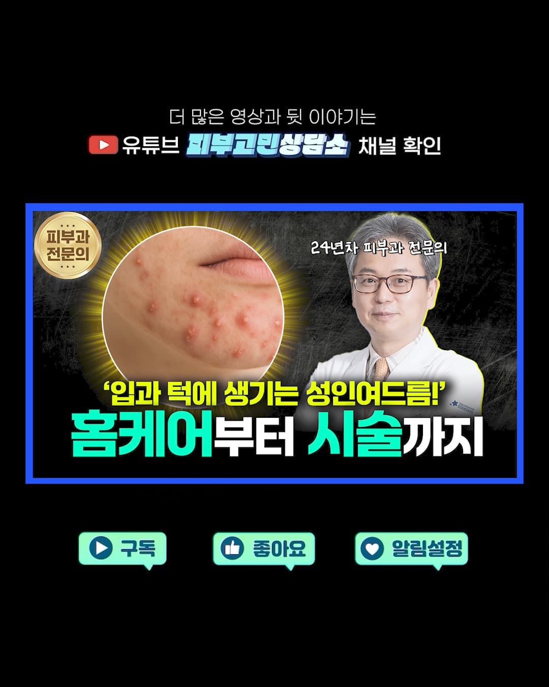 经常出现在嘴部和下巴周围的