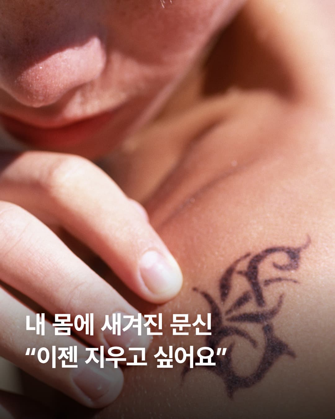 문신제거, 단순히 ‘지우는 것’이 아닙니다.