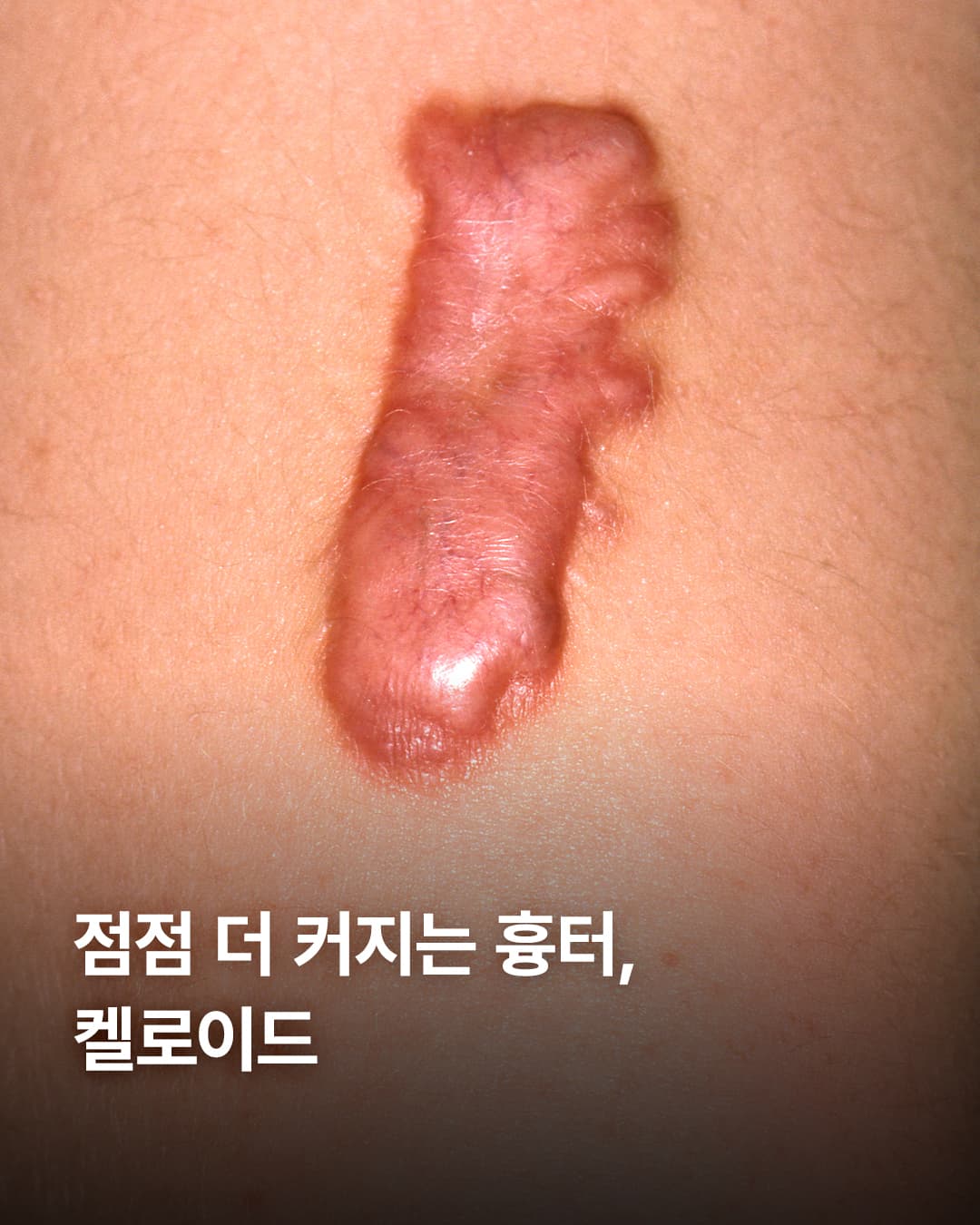 “이거 계속 더 커지는 거 아니야…?”