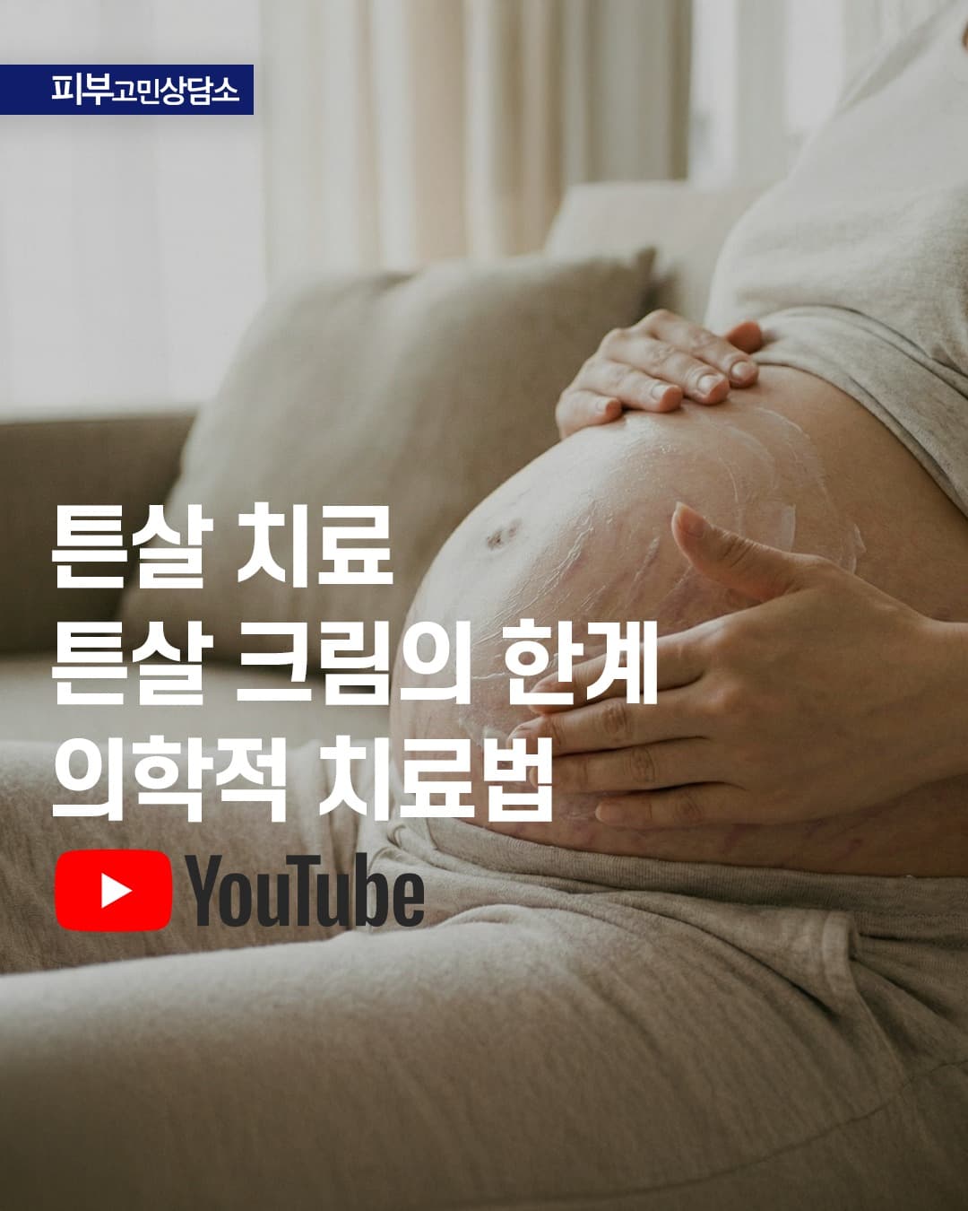 비싼 튼살 크림 열심히 발랐는데 배가 다 텄어요..." "하얗게 변한 튼살은 평생 안 없어진다는데 진짜인가요?