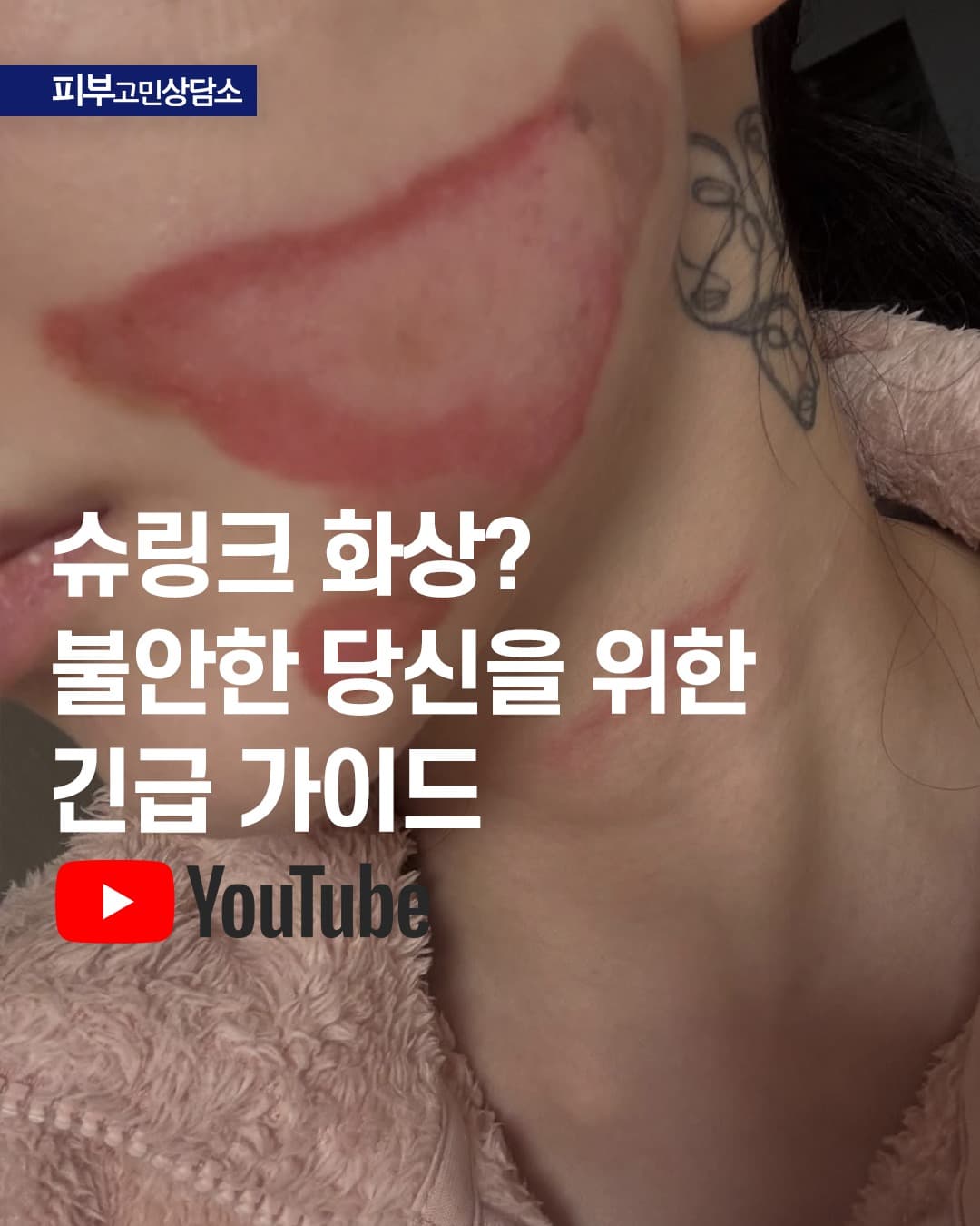 최근 이슈가 된 화상 소식에